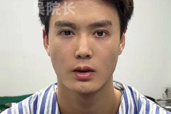 男人颧骨高面相(男人颧骨高面相上怎么说)