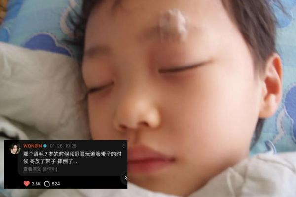 眉毛突然断眉预示什么 眉毛突然断了预示着什么