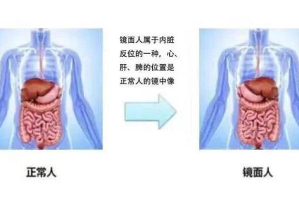 怀了镜面人是不吉利 镜面人能生孩子吗