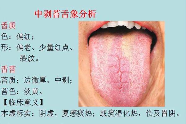 口张舌露的三大生肖 口张舌露指的什么生肖