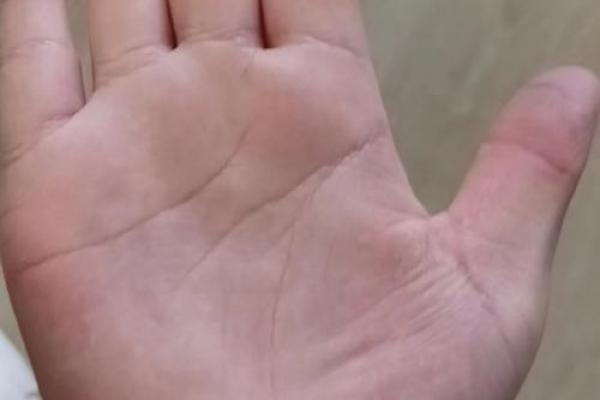头脑笨的人手相 脑子聪明手笨