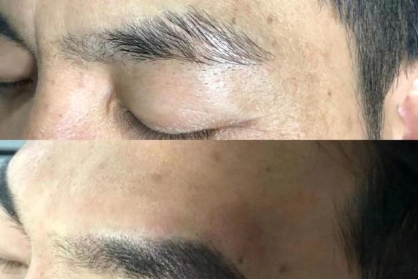 左边眉毛断眉预示了什么 左边眉毛突然断眉是怎么回事
