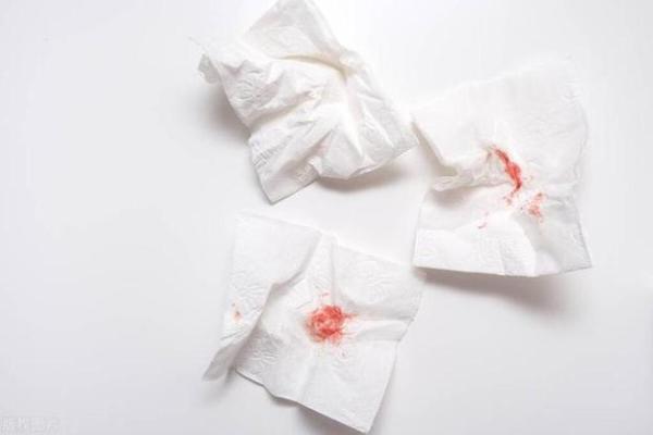 夫妻生活后身体乏力怎么回事 夫妻生活后有褐色分泌物是怎么回事