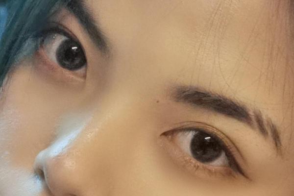 断眉怎么补救 断眉怎么补救最有效