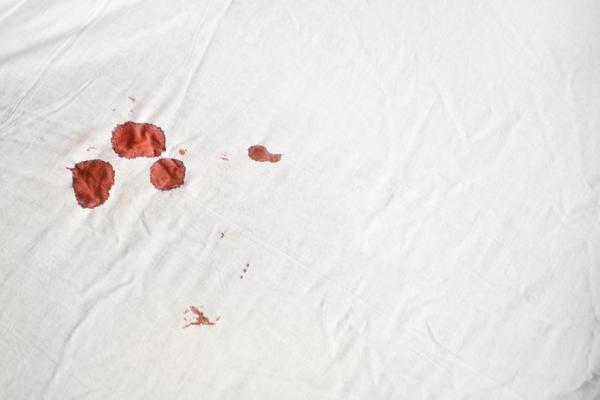 夫妻性生活出血是什么原因 夫妻性生活出血是什么原因是还掉了么