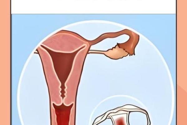 夫妻生活女性出血是什么原因引起的 夫妻生活出血是什么原因造成的女性