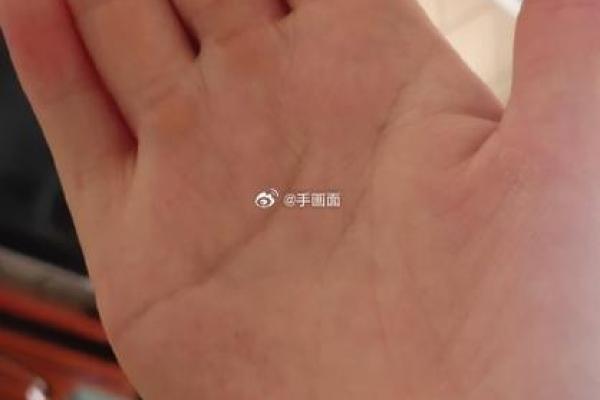 无名指快和中指一样长代表什么 无名指和中指麻木是怎么回事