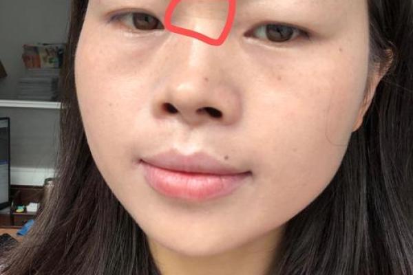 眉中横纹有什么说法 眉中间有横纹是心脏不好吗