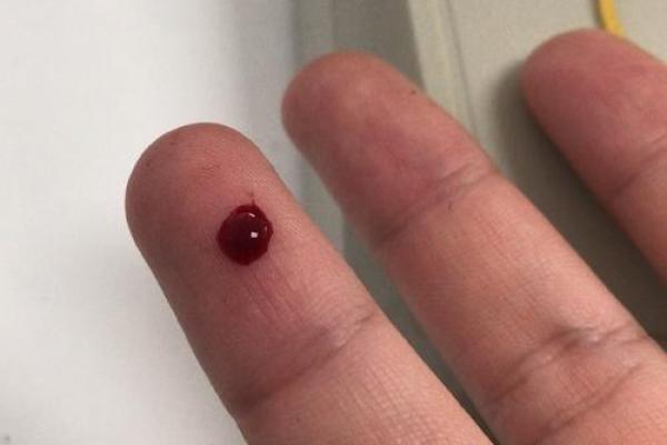 怎么知道血光之灾破了 怎么看血光之灾