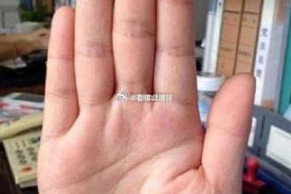 无名指比中指长代表什么意思 无名指中指麻是什么原因,怎么治疗