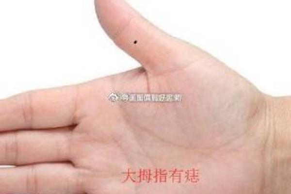 手上长痣面相图(手上长痣有危险吗)
