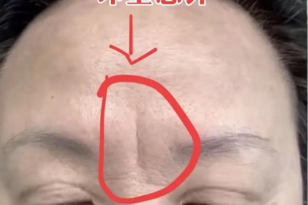 眉毛中间断了有什么说法 眉毛中间有一条竖纹怎么回事