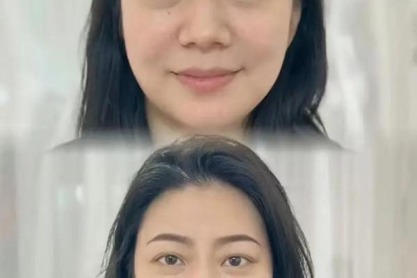 眉毛断了 眉毛断了预示着什么