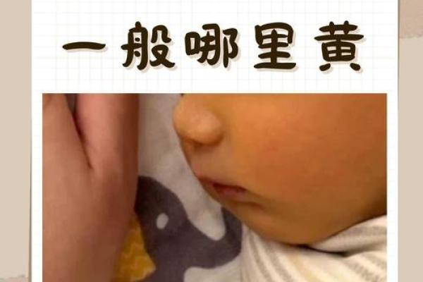 黄疸高峰期一般是哪几天 黄疸高峰期一般是哪几天开始