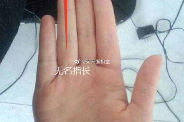 食指长的人多还是无名指长的人多 食指比无名指长的人多还是无名指比食指长的人多