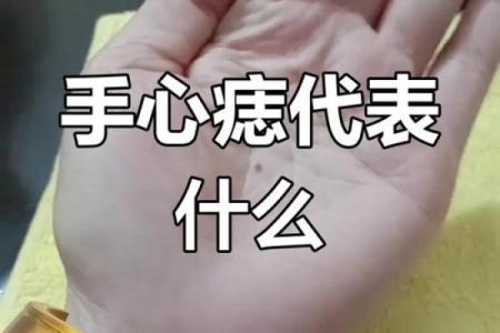 手痣的位置与命运图(手痣的位置代表什么意思)