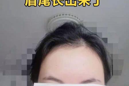 后天摔的眉毛算断眉吗 摔跤把眉毛摔掉了还会长吗