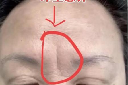 眉毛中间断了有什么说法 眉毛中间有一条竖纹怎么回事