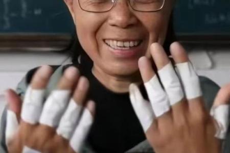 张桂梅双手布满膏药被搀扶