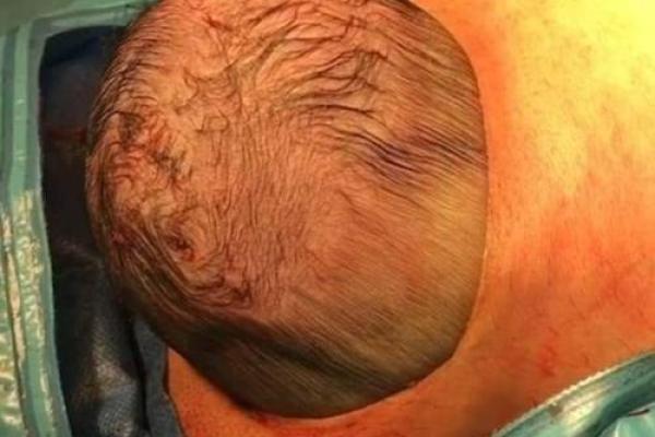 专业医生解读剖腹产吉日选择：结合医学安全与黄道吉日的注意事项